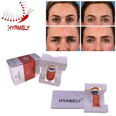 Впрыска токсина Hyamely  материалов Кореи Botulinum для лицевых морщинок