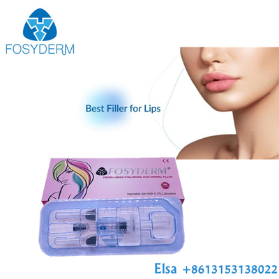 Hyaluronic кисловочный заполнитель Fosyderm дермальный для впрыски 24mg/Ml губ стороны