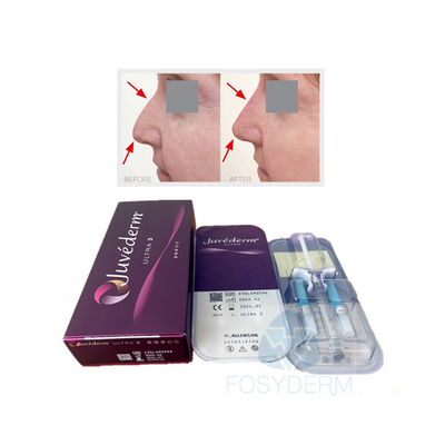 Губа стороны Crosslinked дермальный гель Juvederm Ultra3 заполнителя Hyaluronic кисловочный