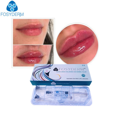 Уход за лицом геля Fosyderm Hyaluronic кисловочный анти- сморщивает дермальную впрыску заполнителей