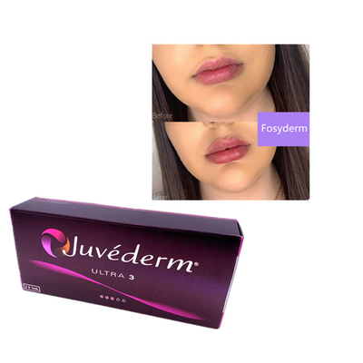 2 мл Juvederm Гиалуроновая кислота Dermal Filler Wrinkle Filler Chin Lips Ultra 3