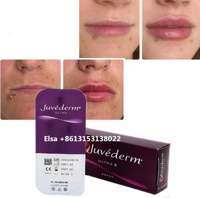 Косметика Уход за кожей Инъекции для губ Плампер Juvederm Наполнитель Инъекция для носа Подбородок