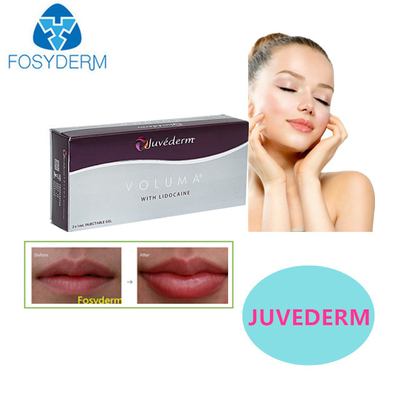 Juvederm Гиалуроновая кислота для наполнения кожи Сексуальные губы 24 мг Для наполнения лица