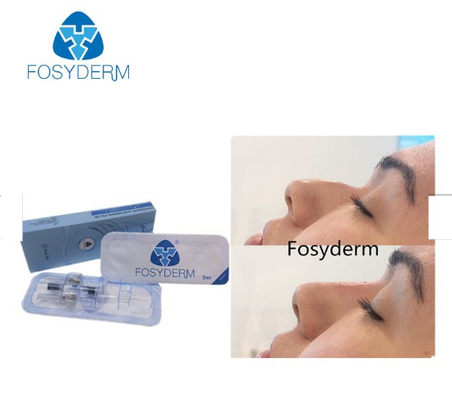 Крест Fosyderm соединил глубокую линию заполнитель заполнителя 2ml дермальный для носа вверх