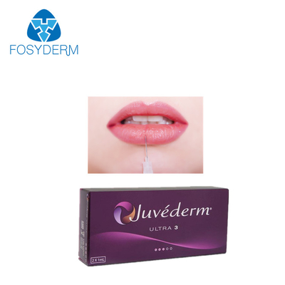 Заполнитель ультра 3 Hyaluronic кисловочный дермальный 2*1ml Juvederm губы