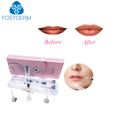дермальный крест 2ml соединил Hyaluronic заполнители ручки
