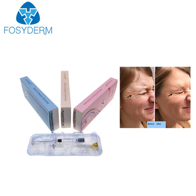Заполнитель коллагена геля Hyaluronic кисловочный вводимый дермальный
