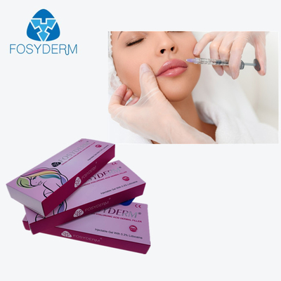 Перекрестный соединенный заполнитель 2Ml Derm HA дермальный для того чтобы достигнуть повышения губ мимо впрыскивает