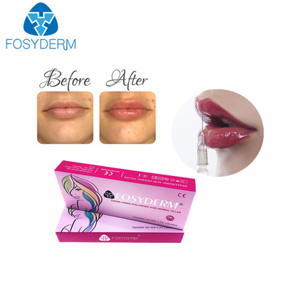 hyaluronic кисловочная впрыска повышения губы Derm заполнителей губы 1ml для женщин