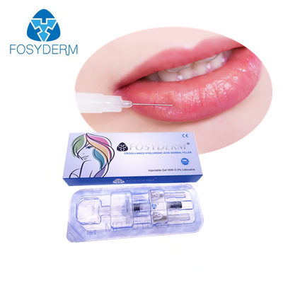 впрыска заполнителя вводимого BDDE образования поперечных связей 2ml Hyaluronic кисловочная для тома губы