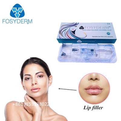 Fosyderm 1 мл гиалуроновой кислоты для увеличения размеров губ
