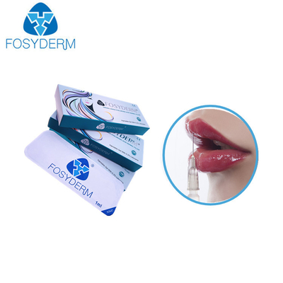 1,1 Ml Mg повышения 24 губ заполнителей Derm Hyaluronic кисловочного с Lidocaine