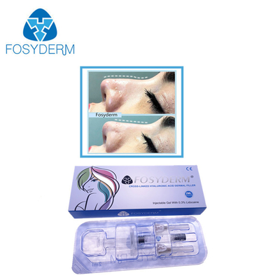Линия Hyaluronic кисловочный дермальный нос 2 Ml глубокая заполнителя вверх с Lidocaine