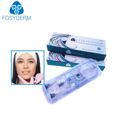 заполнителей губы 1.1ml Derm заполнитель стороны дермальных Hyaluronic кисловочный вводимый