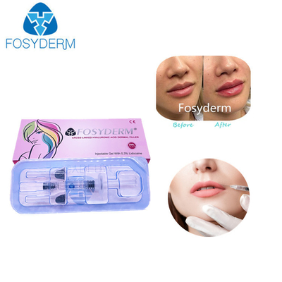 Крест 2 Ml кисловочный Hyaluronic соединил дермальные впрыски заполнителя губы заполнителя