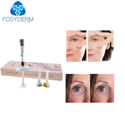 Уход за лицом заполнителя морщинки глаза Hyaluronic кисловочный дермальный сморщивает заполнитель впрыски