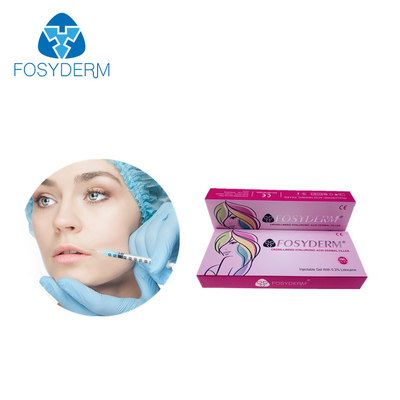 Заполнителей губы Fosyderm 2ml заполнитель впрысок дермальных Hyaluronic кисловочный дермальный