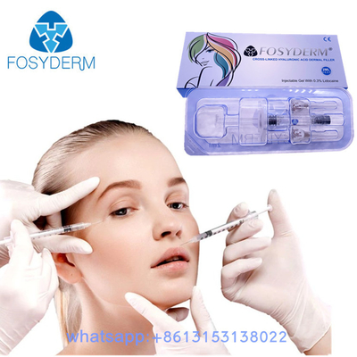 24 Mg/Ml заполнителя HA заполнителя Fosyderm впрыски геля лицевого дермального Hyaluronic кисловочные