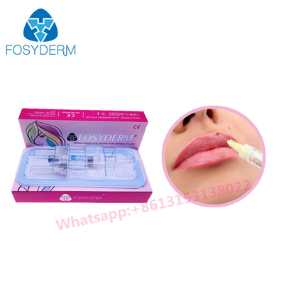 Крест заполнителя губы кислоты Fosyderm Hyaluronic не инвазионный соединил заполнители HA