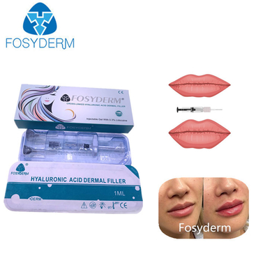 крест 1ml соединил Hyaluronic кисловочный дермальный заполнитель для губ обнюхивает Chin