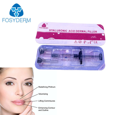 наполненность губ 2ml путем впрыскивать заполнитель Fosyderm Hyaluronic кисловочный дермальный