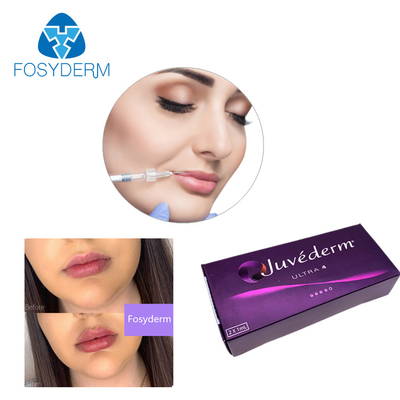 Заполнитель 24mg/Ml губы Juvederm геля заполнителя Ultra3 Ultra4 Voluma Hyaluronic кисловочный дермальный
