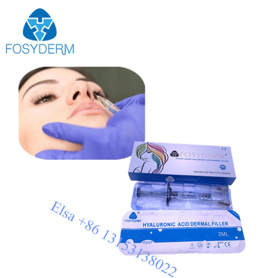 Заполнитель Fosyderm вводимый Hyaluornic кисловочный дермальный с заполнителями стороны носа губы lidociane 2ml