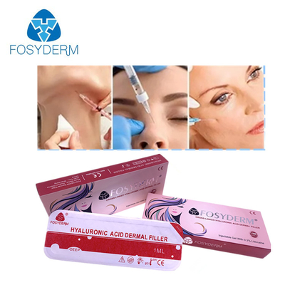 Щека заполнения губы поднимая лицевой заполнитель вводимое Fosyderm 2ml HA дермальный